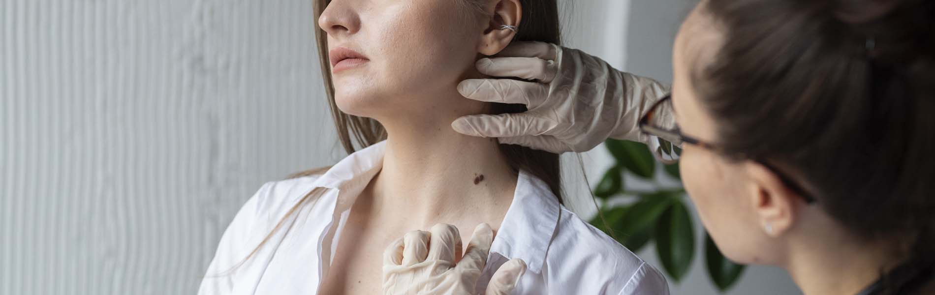 Melanoma, and why its timely diagnosis is important!