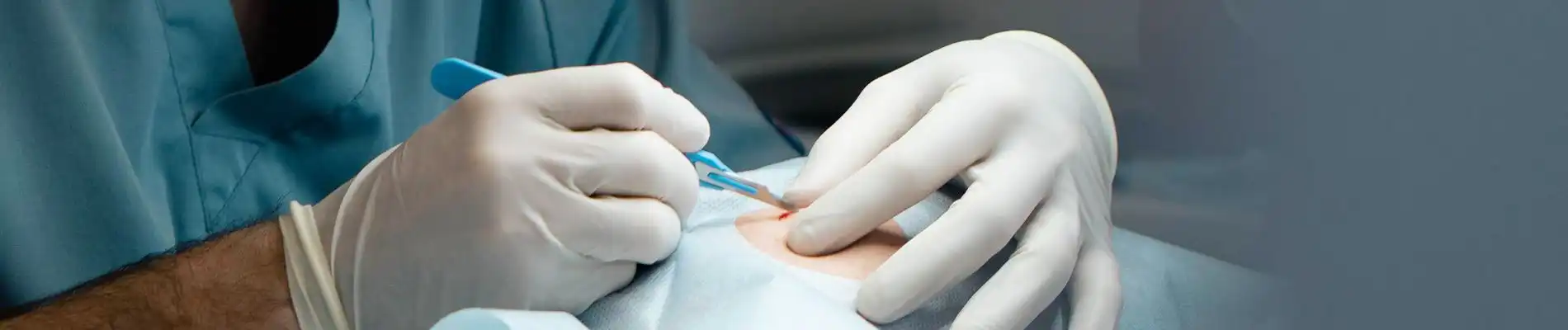 Punch biopsy