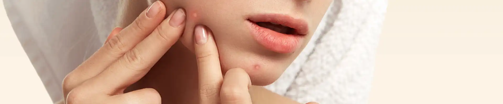 Removal of molluscum contagiosum