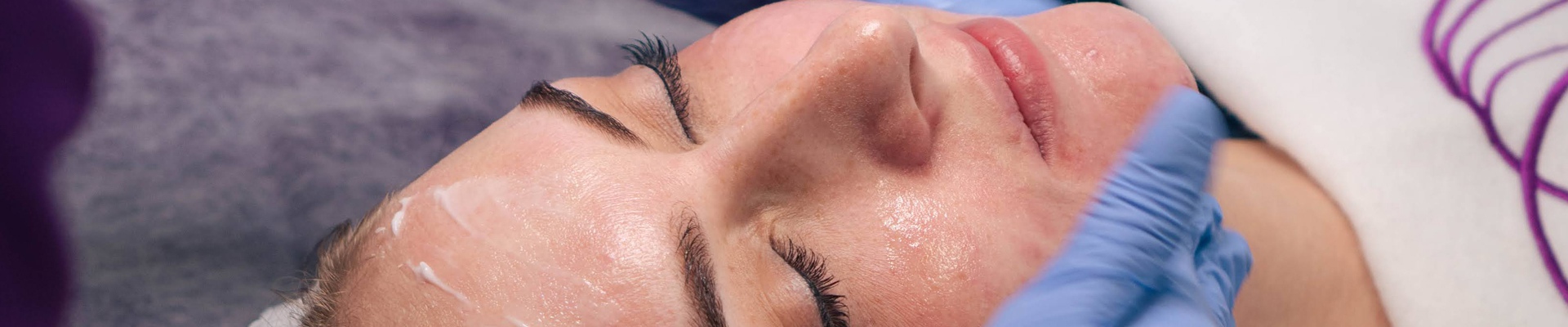 Face peeling