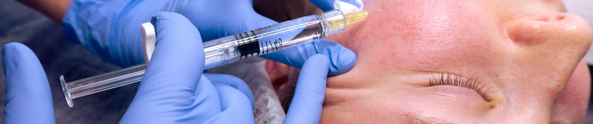 Plinest Injections