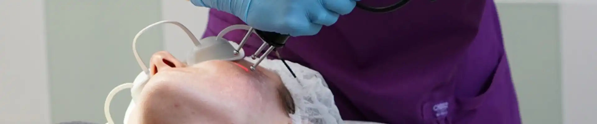 Laser Resurfacing