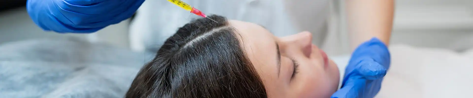 Scalp Mesotherapy