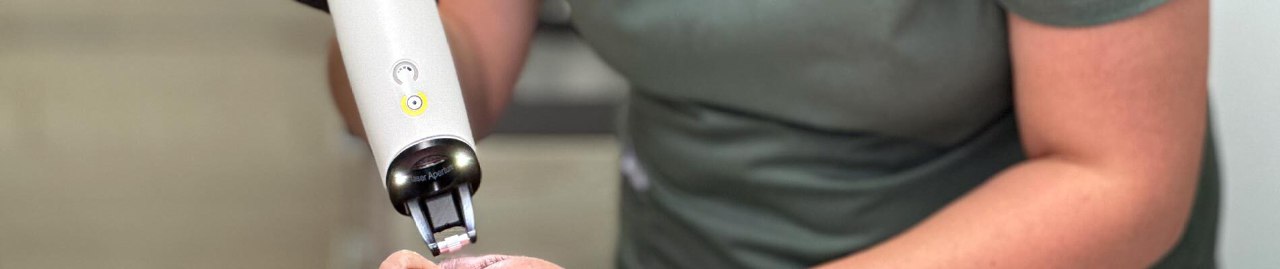 Фракційна система Сandela Frax Pro – ціна, відгуки в Леодерм